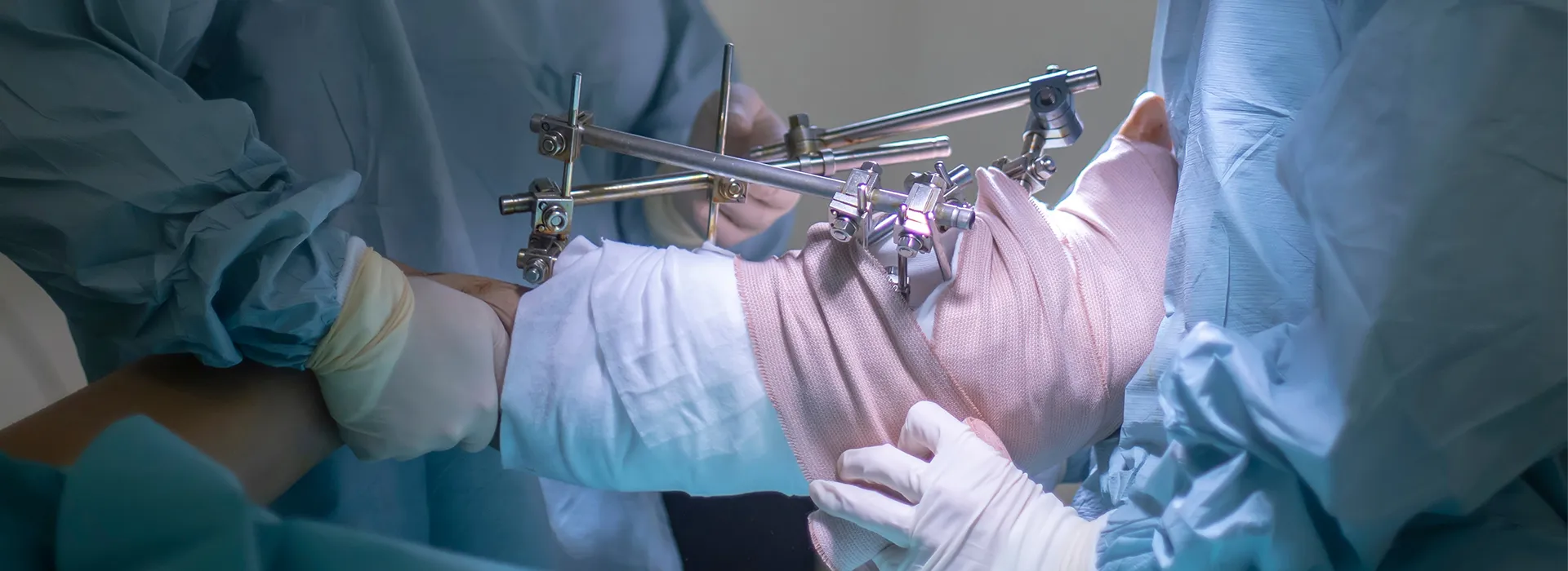 Programa en Desarrollo Profesional Permanente en Cirugía de Reconstructiva Y Alargamiento Óseo DPP Javeriana Cali Programa en Desarrollo Profesional Permanente en Cirugía de Reconstructiva Y Alargamiento Óseo DPP Javeriana Cali